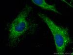 SPATA2 Antibody in Immunocytochemistry (ICC/IF)
