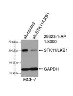 STK11/LKB1 Antibody in Western Blot (WB)