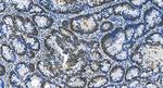 FOXK1 Antibody in Immunohistochemistry (Paraffin) (IHC (P))