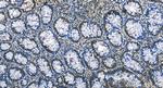 FOXK1 Antibody in Immunohistochemistry (Paraffin) (IHC (P))