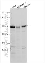FOXK1 Antibody in Western Blot (WB)