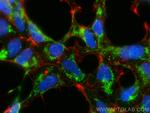 ND3 Antibody in Immunocytochemistry (ICC/IF)