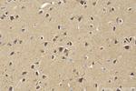 HDAC5 Antibody in Immunohistochemistry (Paraffin) (IHC (P))