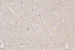 ABR Antibody in Immunohistochemistry (Paraffin) (IHC (P))