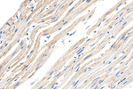 NPPC Antibody in Immunohistochemistry (Paraffin) (IHC (P))