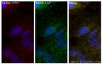 INPP5E Antibody in Immunocytochemistry (ICC/IF)
