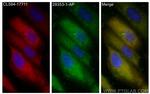 INPP5E Antibody in Immunocytochemistry (ICC/IF)