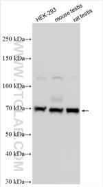 INPP5E Antibody in Western Blot (WB)