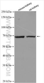 SLC6A19 Antibody in Western Blot (WB)