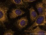 VPS13D Antibody in Immunocytochemistry (ICC/IF)