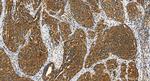 VPS13D Antibody in Immunohistochemistry (Paraffin) (IHC (P))
