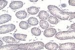RAD50 Antibody in Immunohistochemistry (Paraffin) (IHC (P))