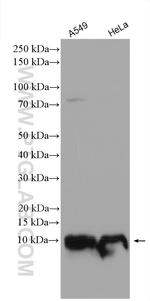 IER3IP1 Antibody in Western Blot (WB)