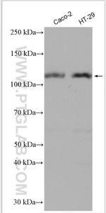 DPP4/CD26 Antibody in Western Blot (WB)