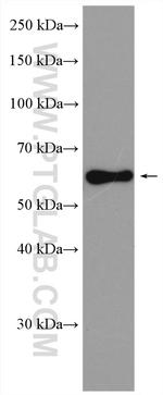 TCFL5 Antibody in Western Blot (WB)
