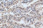 FAM111B Antibody in Immunohistochemistry (Paraffin) (IHC (P))