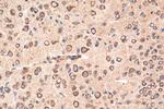 NHLRC2 Antibody in Immunohistochemistry (Paraffin) (IHC (P))