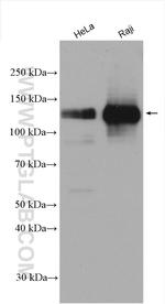 INCENP Antibody in Western Blot (WB)