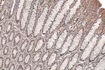 PPP1R3C Antibody in Immunohistochemistry (Paraffin) (IHC (P))