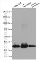 PPP1R3C Antibody in Western Blot (WB)