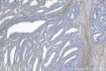 Fibrillin 1 Antibody in Immunohistochemistry (Paraffin) (IHC (P))