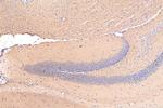 PLXNB1 Antibody in Immunohistochemistry (Paraffin) (IHC (P))