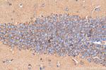 PLXNB1 Antibody in Immunohistochemistry (Paraffin) (IHC (P))
