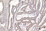 YTHDC1 Antibody in Immunohistochemistry (Paraffin) (IHC (P))