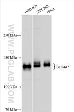 NBCn1 Antibody in Western Blot (WB)