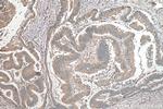 ATG16L1 Antibody in Immunohistochemistry (Paraffin) (IHC (P))