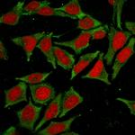 Glutathione S-Transferase Mu2 (GSTM2) Monoclonal Antibody (CPTC-GSTMu2-2)