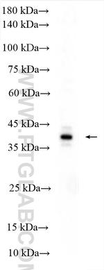 ERAL1 Antibody in Western Blot (WB)