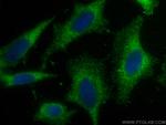 HHIP Antibody in Immunocytochemistry (ICC/IF)