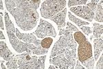 HHIP Antibody in Immunohistochemistry (Paraffin) (IHC (P))