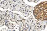 HHIP Antibody in Immunohistochemistry (Paraffin) (IHC (P))