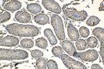 HHIP Antibody in Immunohistochemistry (Paraffin) (IHC (P))
