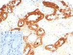 Glutathione S-Transferase Mu3 (GSTM3) Recombinant Mouse Monoclonal Antibody (rGSTM3/8878)