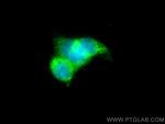PLOD1 Antibody in Immunocytochemistry (ICC/IF)