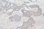 PLOD1 Antibody in Immunohistochemistry (Paraffin) (IHC (P))