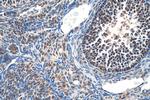 INO80B Antibody in Immunohistochemistry (Paraffin) (IHC (P))
