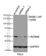 INO80B Antibody in Western Blot (WB)