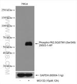 Phospho-P62/SQSTM1 (Ser349) Antibody in Western Blot (WB)