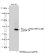 Phospho-P62/SQSTM1 (Ser349) Antibody in Western Blot (WB)