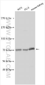 TM9SF4 Antibody in Western Blot (WB)
