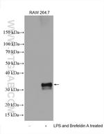 IL-1 beta Antibody in Western Blot (WB)