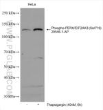 Phospho-PERK/EIF2AK3 (Ser719) Antibody in Western Blot (WB)
