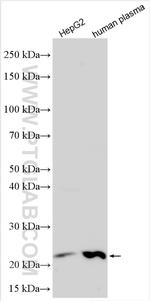 RBP4 Antibody in Western Blot (WB)