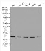 BAK Antibody in Western Blot (WB)