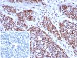 MSH6 (DNA Mismatch Repair Protein) Recombinant Mouse Monoclonal Antibody (rMSH6/8337)