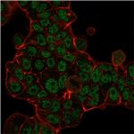MSH6 (DNA Mismatch Repair Protein) Monoclonal Antibody (MSH6, 3085)